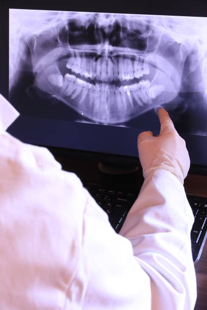Best Emergency Gum Treatment in Hughson, CA