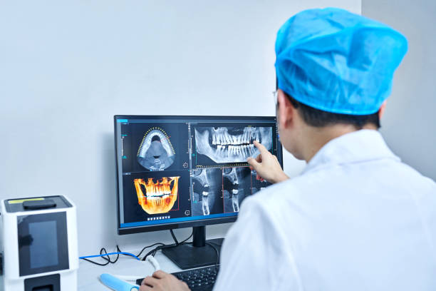 Best Emergency Treatment for Dental Infections or Abscesses in Hughson, CA