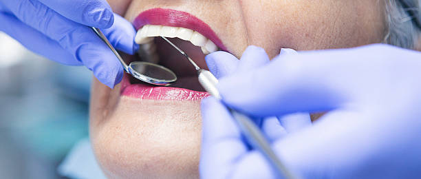 Best Cosmetic Emergency Dentistry in Hughson, CA